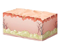 에어젯 리프팅 시술전