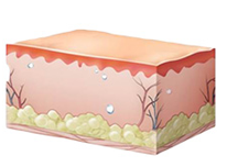 피부재생으로 리프팅 확인